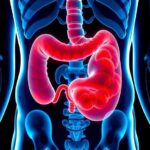 Diverticulitis Its Causes, Symptoms And Treatments