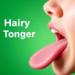 Hairy Tongue Treatment in Homeopathy