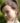 Homeopathic Remedies for Acne