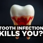 How Long Until a Tooth Infection Kills You?